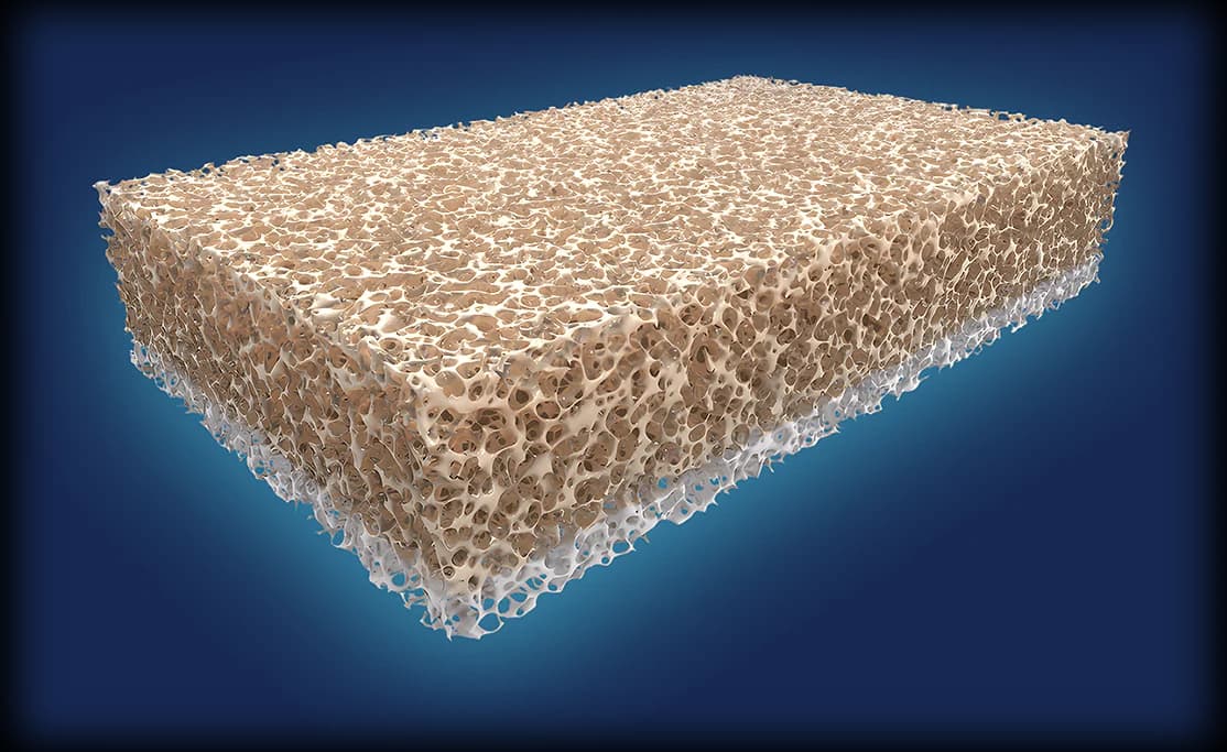 BioEnthesis Interpositional Biphasic Cancellous Allograft