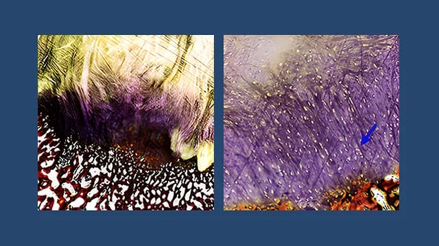 Histology comparison: denser fiber formation and reduced inflammation with BioEnthesis versus standard of care in ovine model